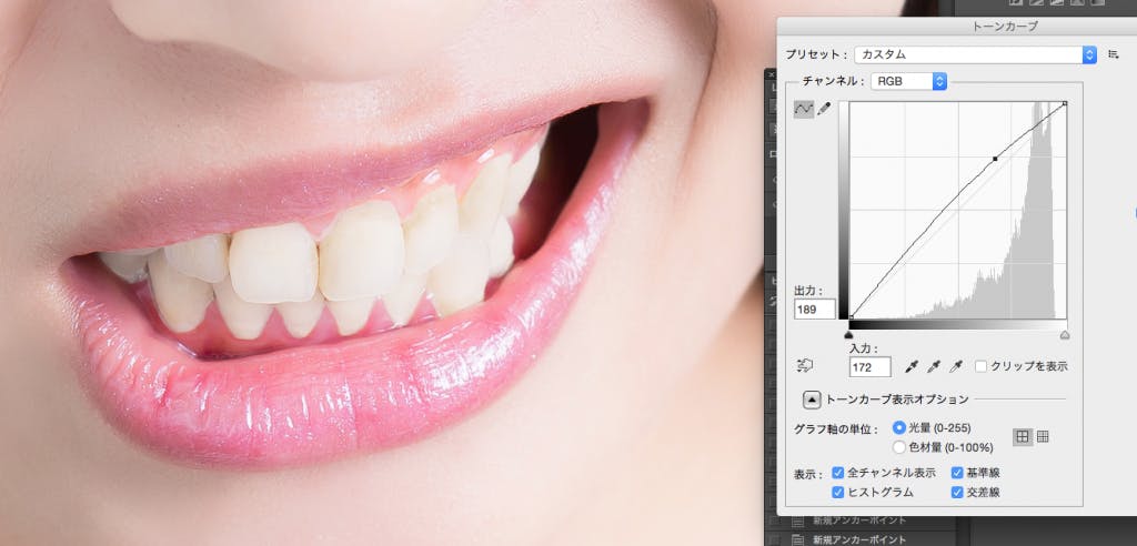 レタッチテクニック7|人物の歯を白くする Photo by Mphoto