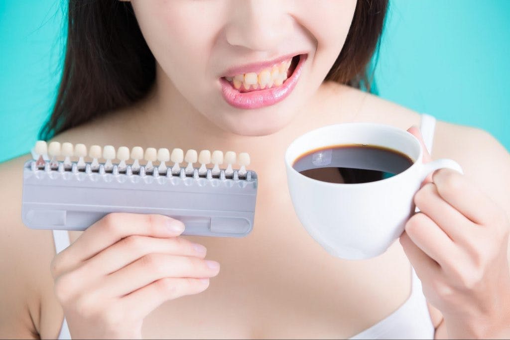 レタッチテクニック7|人物の歯を白くする Photo by Mphoto