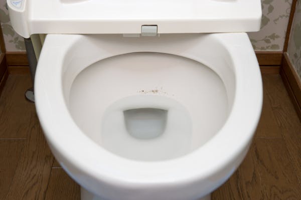 黒ずみの付いたトイレの便器